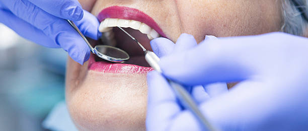 Best Emergency Dentist for Lost Fillings or Crowns in Manahawkin, NJ